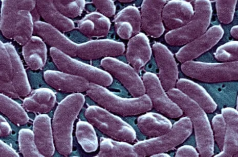 Louisiana Confirms Five Deaths from Flesh-Eating Bacteria in Coastal Waters